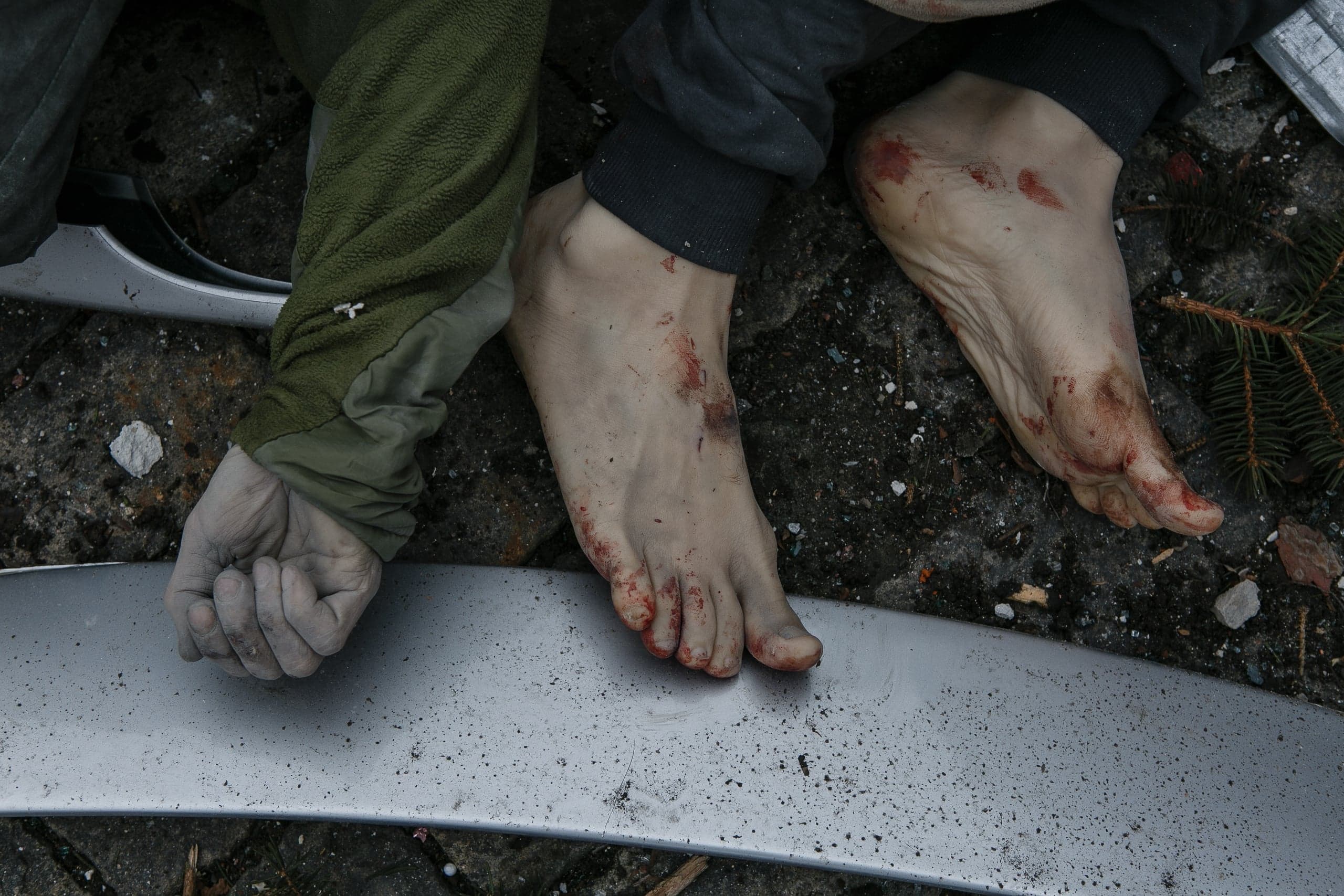 Окровавленные босые ступни и пыльная рука в зеленом рукаве лежат на обломках.